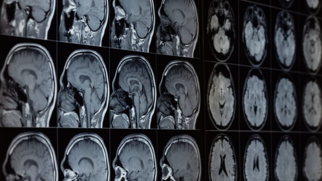 MRIs-1200x675.jpg