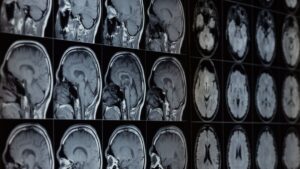 MRIs-1200x675.jpg