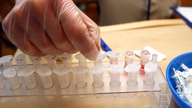 blood-test-tubes-090312-1180.jpg