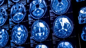 brainscan-1200x675.jpg