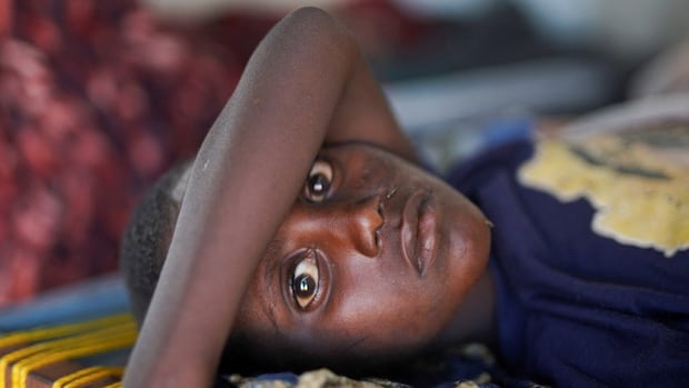 sudan-politics-tawila-cholera.JPG