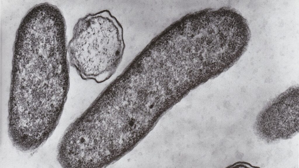vibriobacteria-1200x675.jpg