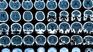 brainscans-1200x675.jpg