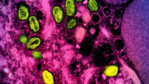 mpox-1200x675.jpg